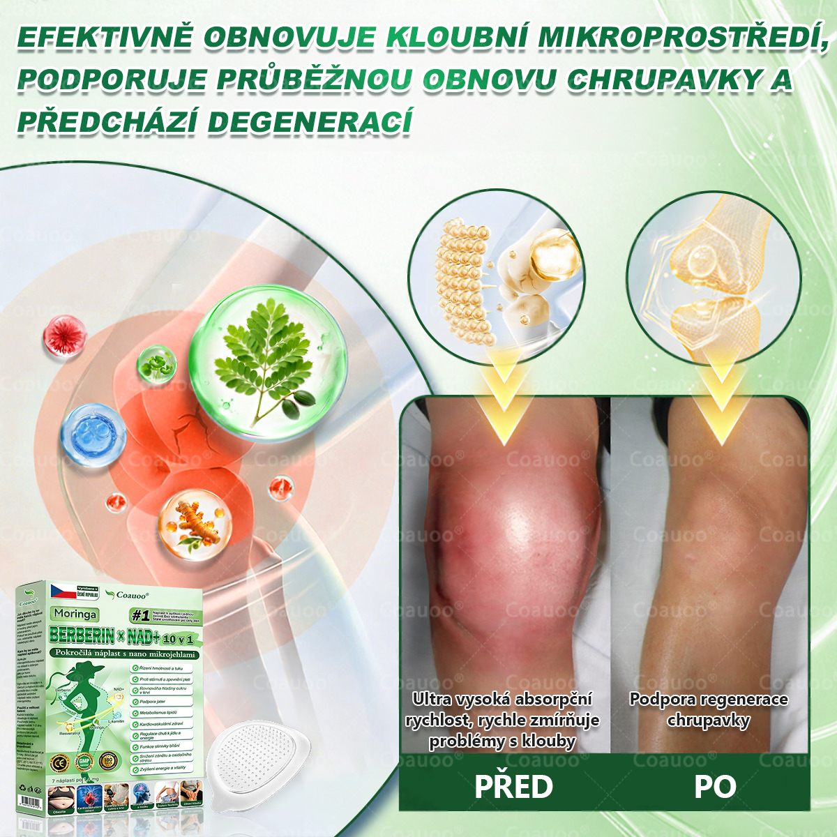 🧑‍⚕️𝐂𝐨𝐚𝐮𝐨𝐨® 𝐌𝐨𝐫𝐢𝐧𝐠𝐚 × 𝐁𝐞𝐫𝐛𝐞𝐫𝐲𝐧𝐚 × 𝐀𝐌𝐏𝐊 𝟏𝟎 v 1 – Zeštíhlující nano mikrojihlový náplast 🇨🇿 Jen 1× denně ✅ Viditelné změny za 7 dní – na obezitu, kardiovaskulární zdraví, diabetes a kloubní problémy