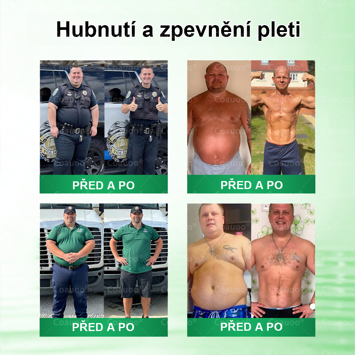 🧑‍⚕️𝐂𝐨𝐚𝐮𝐨𝐨® 𝐌𝐨𝐫𝐢𝐧𝐠𝐚 × 𝐁𝐞𝐫𝐛𝐞𝐫𝐲𝐧𝐚 × 𝐀𝐌𝐏𝐊 𝟏𝟎 v 1 – Zeštíhlující nano mikrojihlový náplast 🇨🇿 Jen 1× denně ✅ Viditelné změny za 7 dní – na obezitu, kardiovaskulární zdraví, diabetes a kloubní problémy