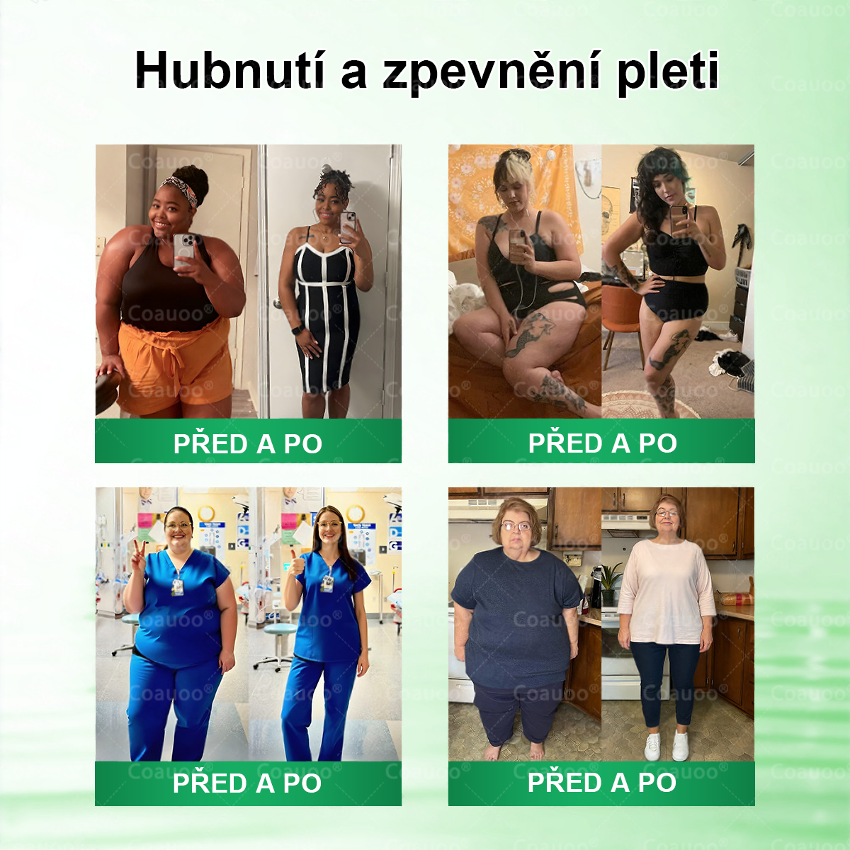 🧑‍⚕️𝐂𝐨𝐚𝐮𝐨𝐨® 𝐌𝐨𝐫𝐢𝐧𝐠𝐚 × 𝐁𝐞𝐫𝐛𝐞𝐫𝐲𝐧𝐚 × 𝐀𝐌𝐏𝐊 𝟏𝟎 v 1 – Zeštíhlující nano mikrojihlový náplast 🇨🇿 Jen 1× denně ✅ Viditelné změny za 7 dní – na obezitu, kardiovaskulární zdraví, diabetes a kloubní problémy
